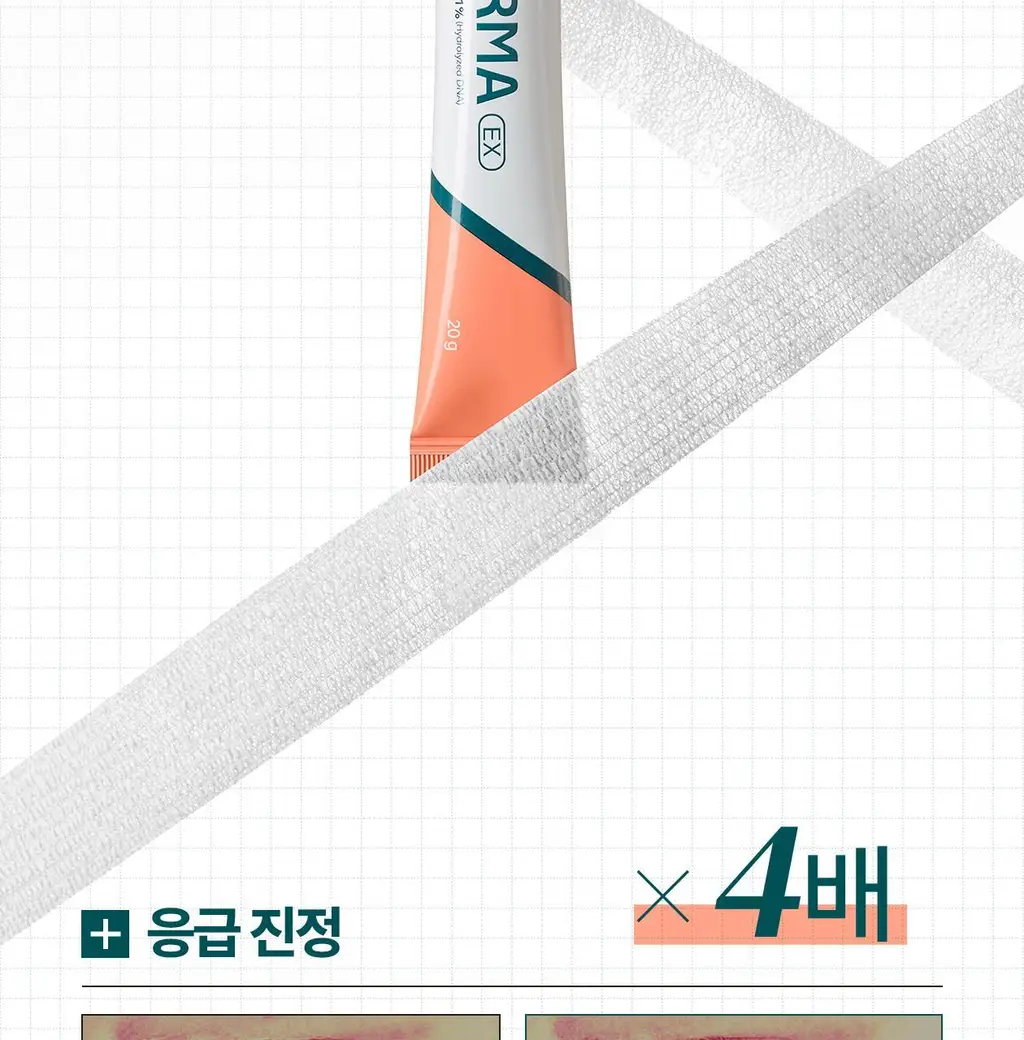 [최모나PICK][리쥬란 제약사_4배속 급속진정] 리쥬더마 EX 리페어링 크림 20g 상세페이지 6